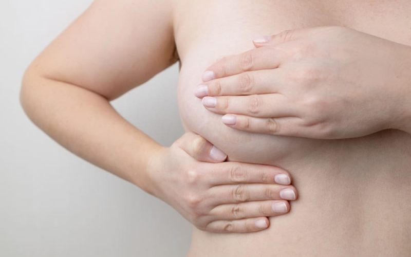 Cómo levantar los senos después del embarazo sin cirugía invasiva